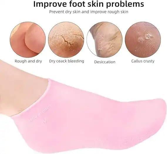 Moisturizing Silicone Spa Gel Socks for Women Men for Dry Feet Cracked Heel Callus Remover Vitamin E Repair (Pink) - ADRO CLOTHING AND ACCESSORIES